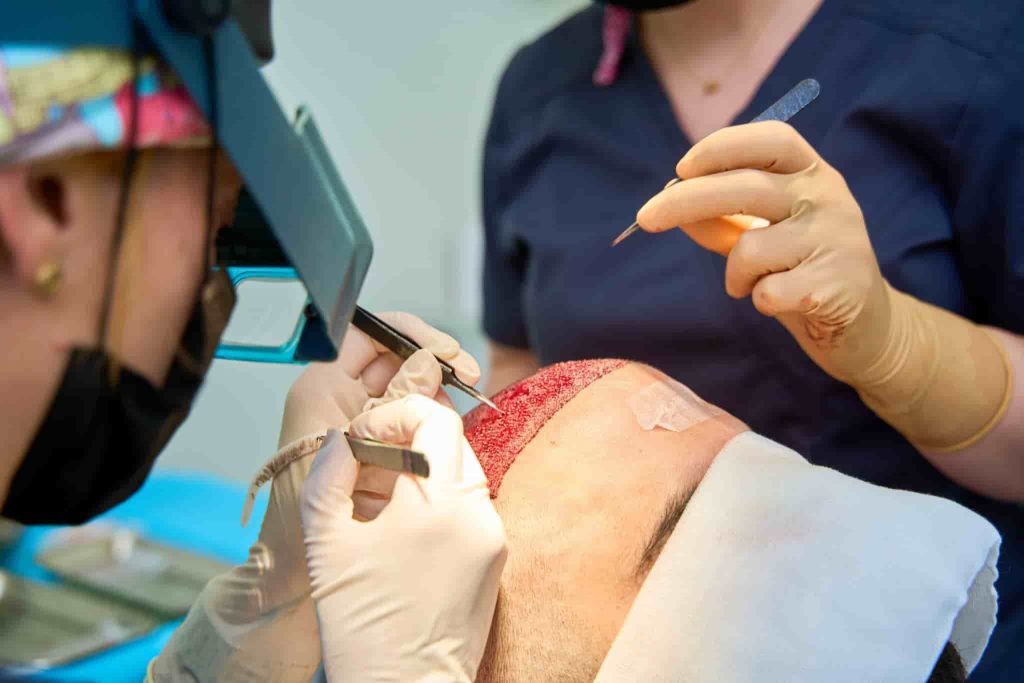 hair loss treatment