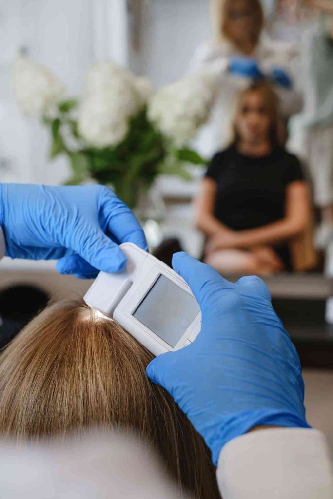 hair loss treatment