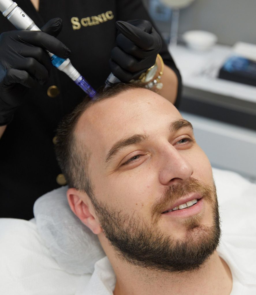 hair loss treatment